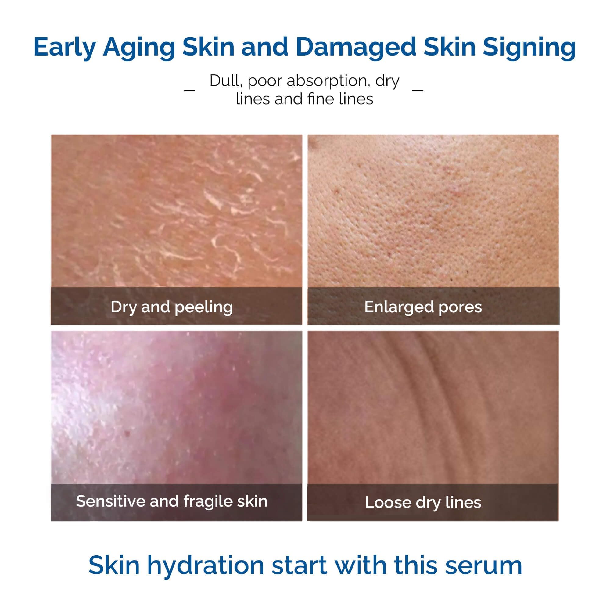 Ageless Elegance Argireline Serum - 11% Argireline Peptide Quality Fine Line Reducer, 1 Fl.Oz